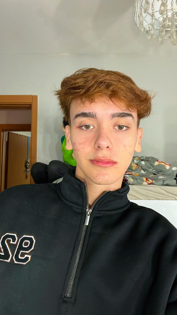Dev 4